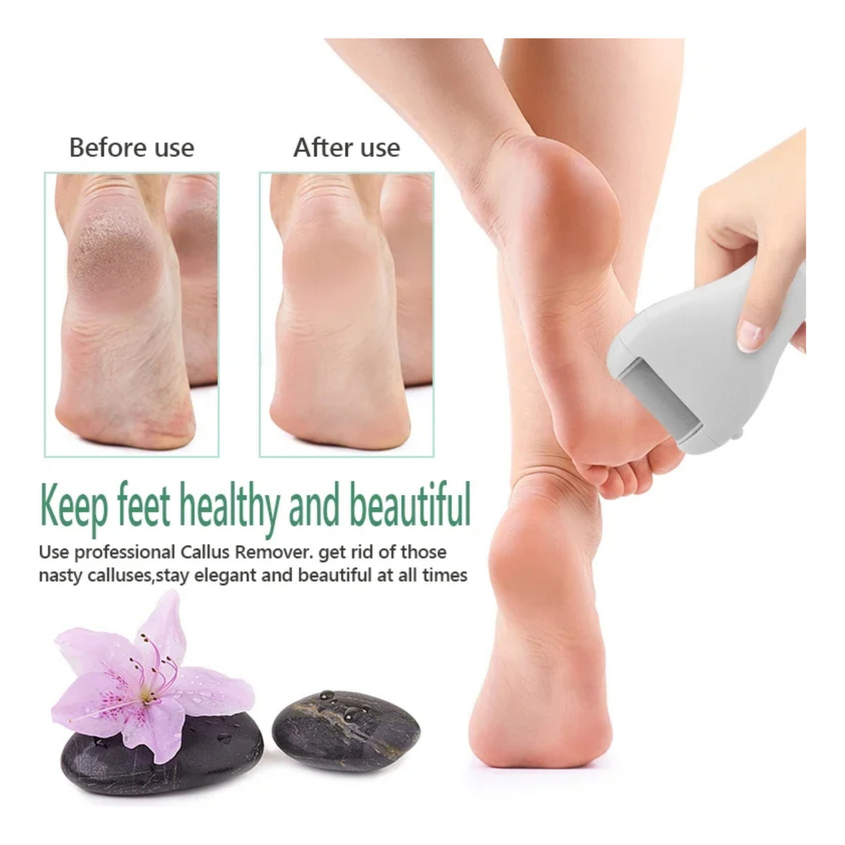 Lima Removedora De Callos Electrica Para Pedicura Usb - Imagen 13