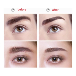 Depilador De Vello Facial Portatil Recargable Alta Calidad - Imagen 12